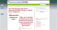 Desktop Screenshot of natural-acne-treatments.com